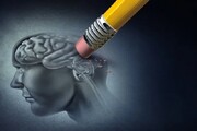 هورمون درمانی خطر زوال عقل را در زنان کاهش می دهد