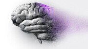 تاثیر سندرم تخمدان پلی کیستیک بر افزایش خطر زوال عقل در زنان
